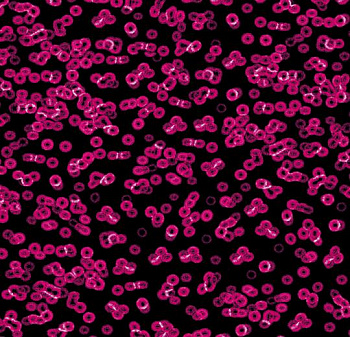 990101 Bacteria